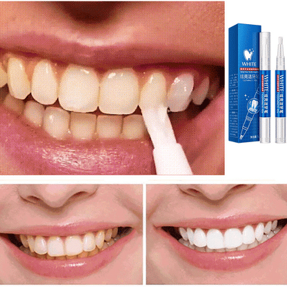 Teeth Whitening Pen