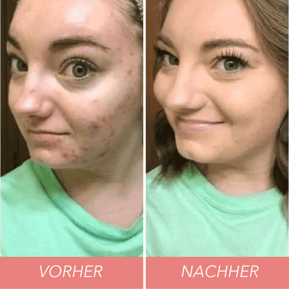 Magic Tri-Color Concealer