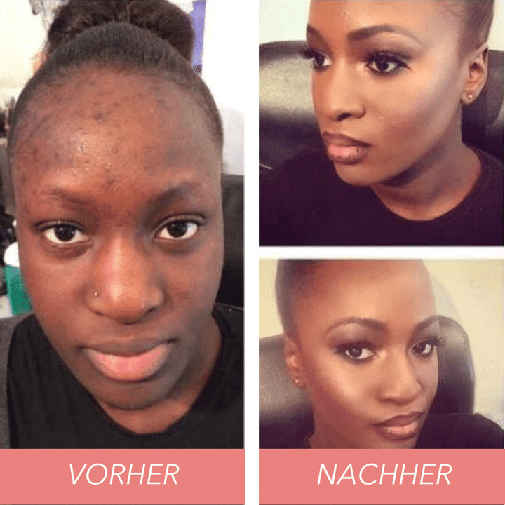 Magic Tri-Color Concealer